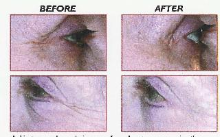 B 39 skin renewal system